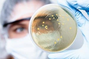 scientist holding a petri dish with specimen